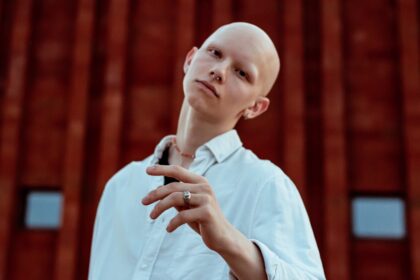 Photo donating to fake cancer fund story