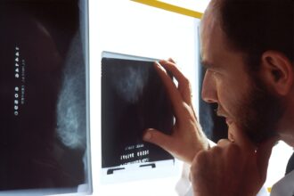 Photo cancer