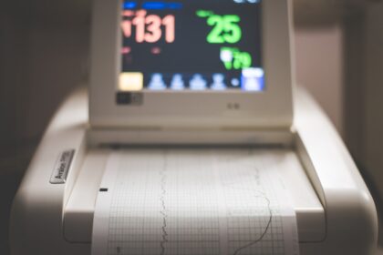 Photo heart rate spike