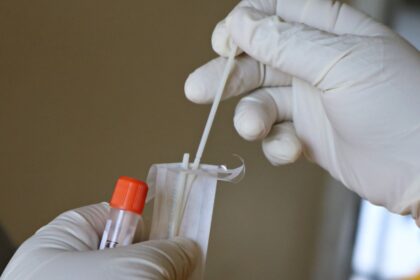 Photo dna test