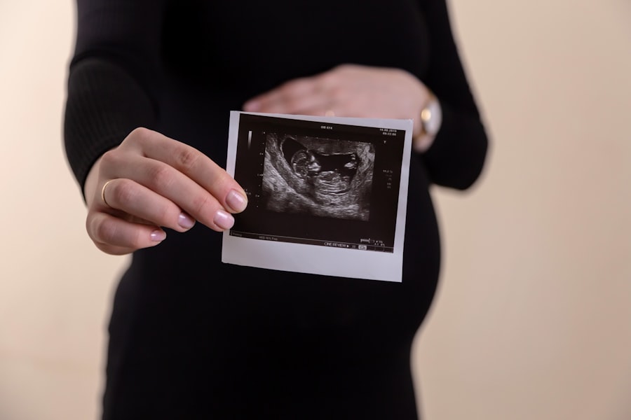 Photo pregnancy due date
